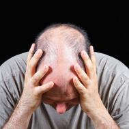 鬼剃头是怎么回事