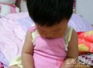宝宝也易患上面瘫