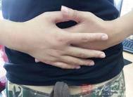 内分泌失调致发胖 长按五个穴位即可解决