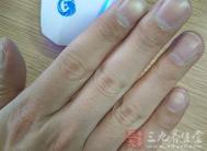 指压手部反射区缓解痛经