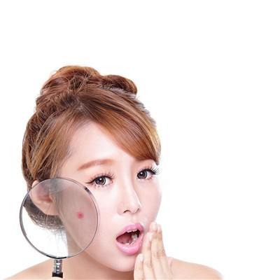 糖有去痘印色斑的功效吗