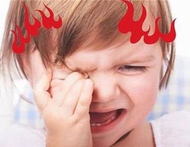 孩子上火的症状有哪些 孩子上火的症状