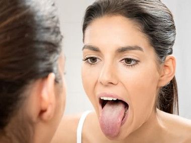 孕妇舌苔发黄是怎么回事 孕妇舌苔发黄是什么原因