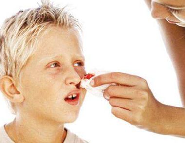 紧急措施：小孩流鼻血处理方法