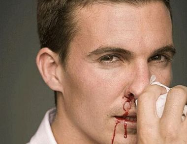 春天空气干燥流鼻血怎么办 教你几招护鼻