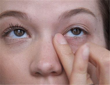 去除眼袋的化妆步骤有些什么