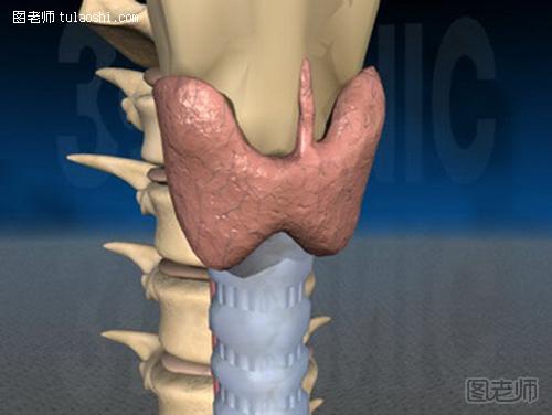 什么是甲状腺钙化 
