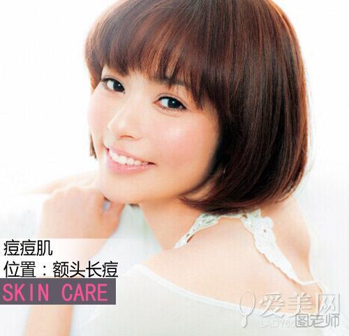 【图】心火旺引起额头长痘痘怎么办|心火旺易