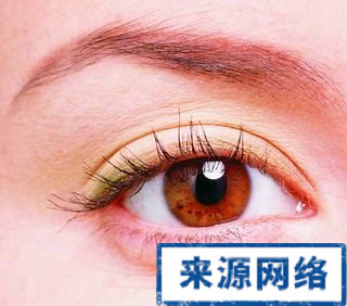 眼睛痒红是不是红眼病|红眼病预防是关键