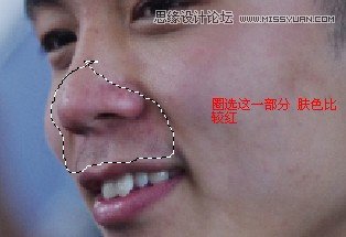 Photoshop详细解析男人脸部去痘美容教程,PS教程,图老师教程网