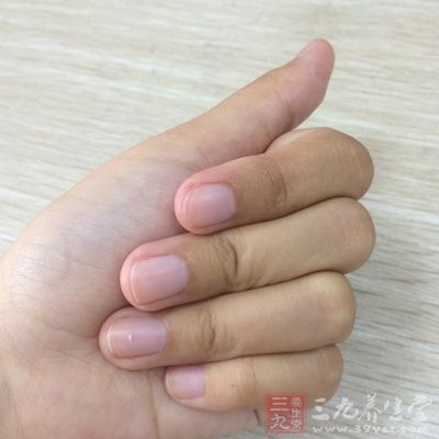 屈腕关节30度，尽量握拳到位