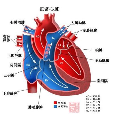 肺动脉高压