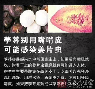 吃荸荠需谨慎，可能会感染姜片虫