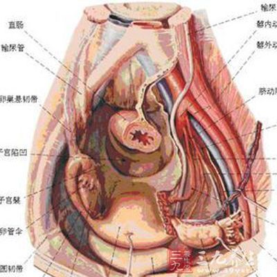 导致盆腔炎的罪魁祸首有外源性和内源性两种，多为混合感染