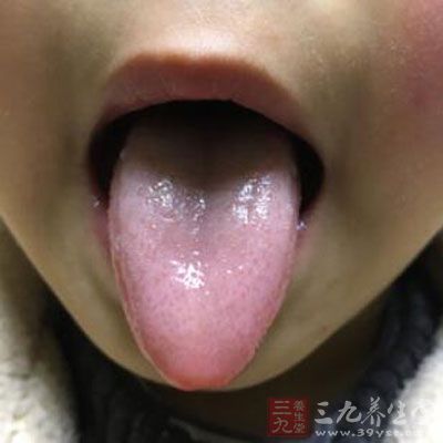 舌上有川形纹，而且纹明显、深又细长、眼可见，则属大富大贵