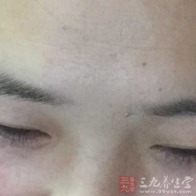 两眉之间可以看肺部是否健康