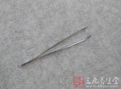 用钳子或镊子将结石夹出