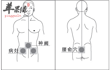 腰俞穴位位置图