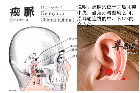 瘈脉穴穴位位置图_瘈脉穴的功效与作用_疗法及注意事项