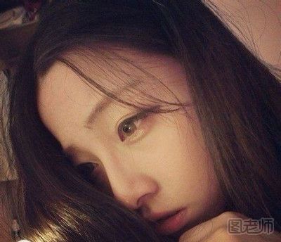 盆腔积液是怎么引起的_盆腔积液有什么原因 为