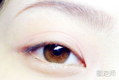 睛发红和充血的原因】_眼睛发红是什么原因 什