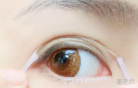 双眼皮贴有哪些种类 看看你最适合哪种双眼皮贴
