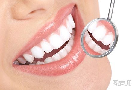 牙套有哪些种类 不同的牙套分别有哪些特点
