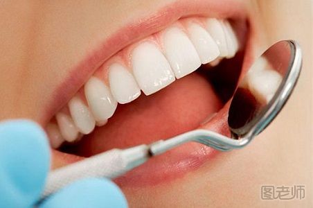 牙套有哪些种类 不同的牙套分别有哪些特点