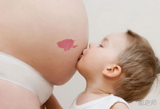  为什么宝宝身上胎记多 宝宝胎记多是什么原因