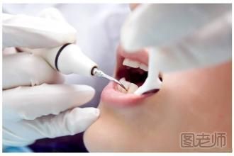 超声波洗牙有什么好处 超声波洗牙的缺点