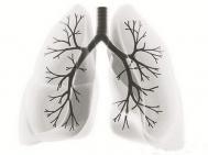 双肺纹理增多是什么意思