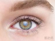 青光眼的早期症状 及早发现及时治疗