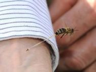 被蜜蜂蛰了怎么消肿？如何处理？