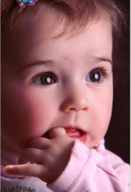 儿童胎记 影响儿童心理发育