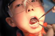 儿童牙齿矫正在多少岁最合适?