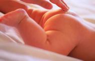 婴儿胎记是怎么形成的 血管的扩张引起