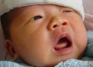 宝宝出现黄疸的原因是什么