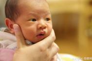 早产儿更容易患婴儿黄疸