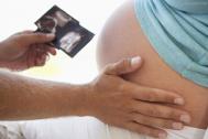 孕期胎动有什么意义呢