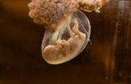 10个月胎儿发育