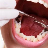 牙疼快速止疼法是什么
