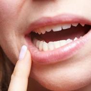 牙痛是什么原因引起的