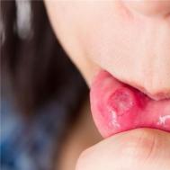 舌头痛是怎么回事