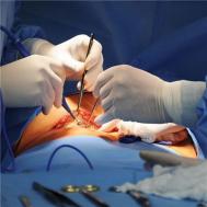 宫腔镜手术过程主要是什么