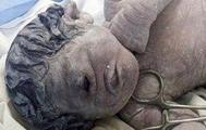 埃及孕妇遭辐射 产下独眼男婴