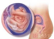 怀孕18周 怀孕18周宝宝的发育情况
