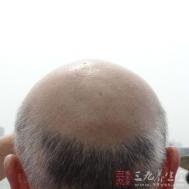男士护肤 不可忽略的耳部保养
