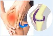 膝盖积水有什么症状？