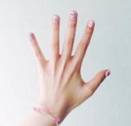 手指甲上有竖纹是什么原因
