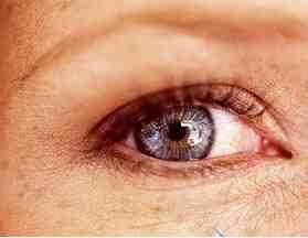 眼角长斑是什么原因